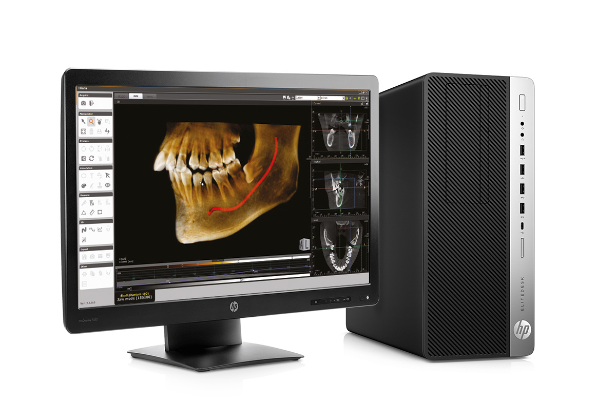HP Computer station - компьютерная станция для дентального 3D томографа.jpg HP Computer station - компьютерная станция для дентального 3D томографа.jpg